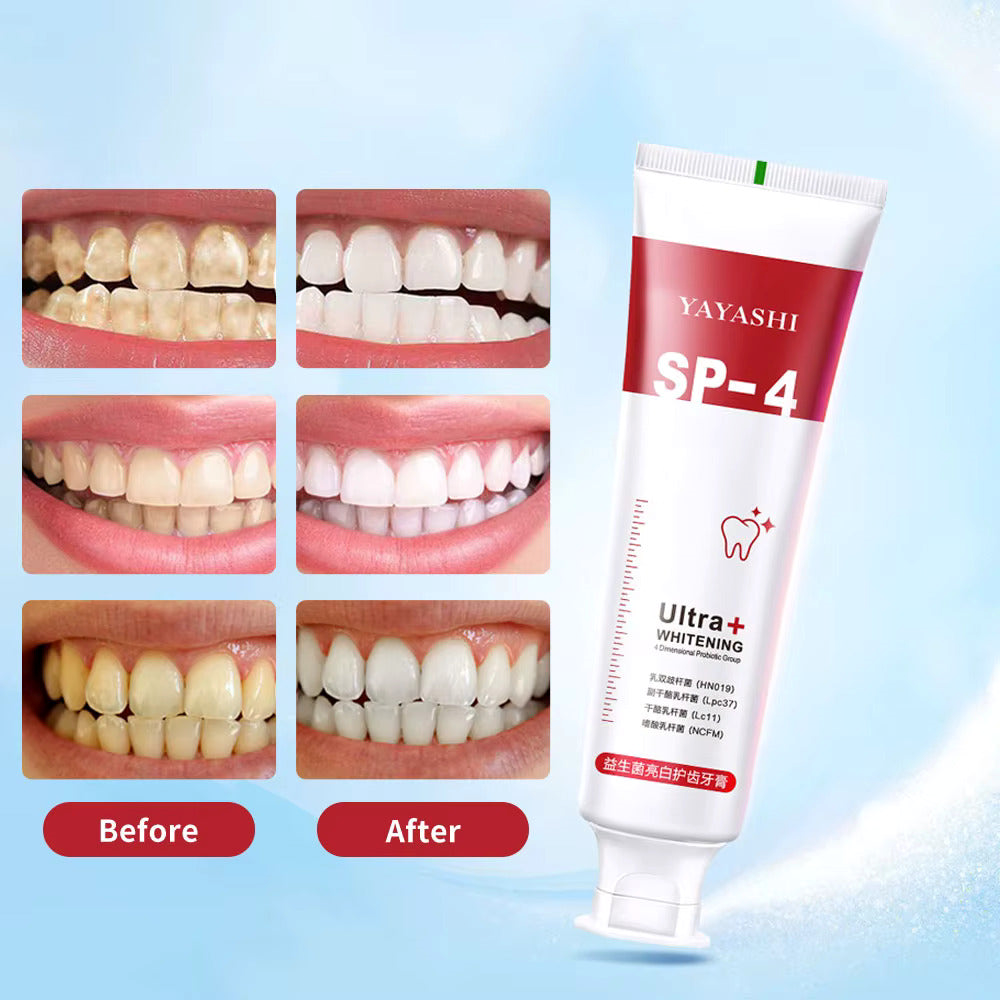 Yayashi SP4 Oral Care Probiotic Whitening Toothpaste 120g – Shine Brighter, Remove Years of Coffee, Tea & Smoking Stains